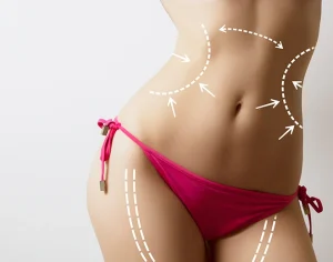 What Areas Of My Body Can I Target With Liposuction?